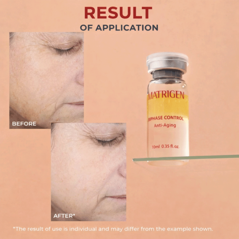 Matrigen Bi Phase Anti-Aging Ampoule Box