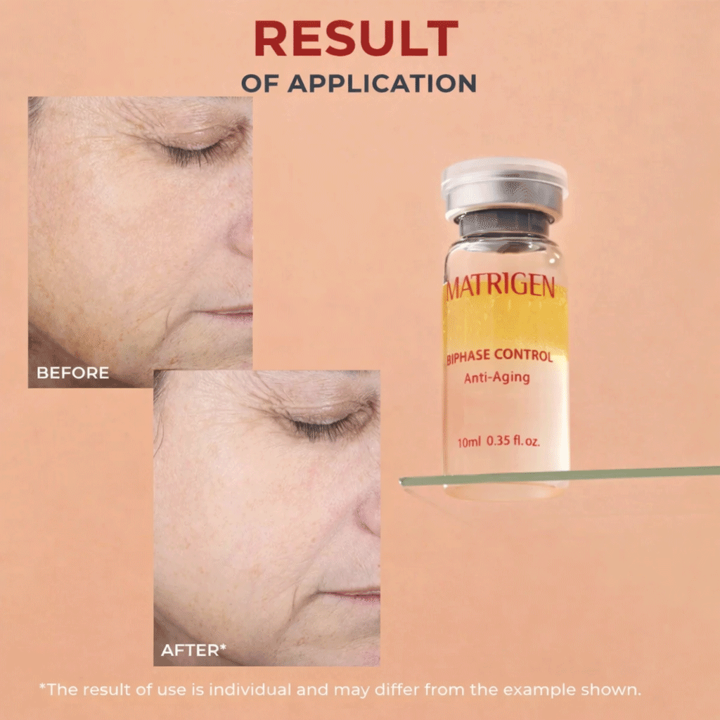Matrigen Bi Phase Anti-Aging Ampoule Box