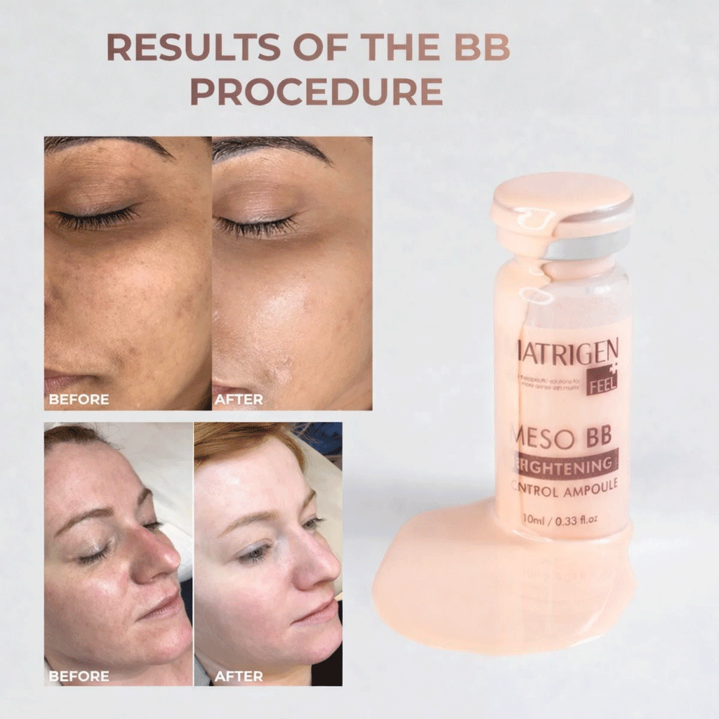 Matrigen Meso BB Brightening Control System