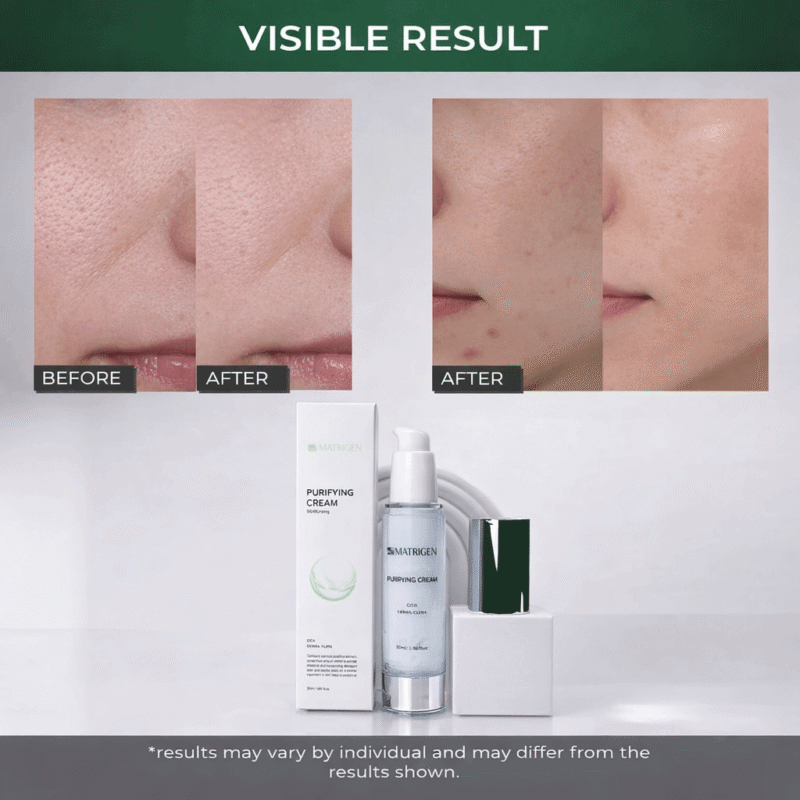 Matrigen Purifying Cream