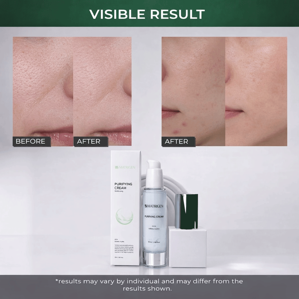 Matrigen Purifying Cream