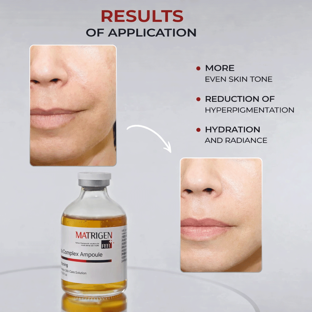 Matrigen Gluta Complex Ampoule