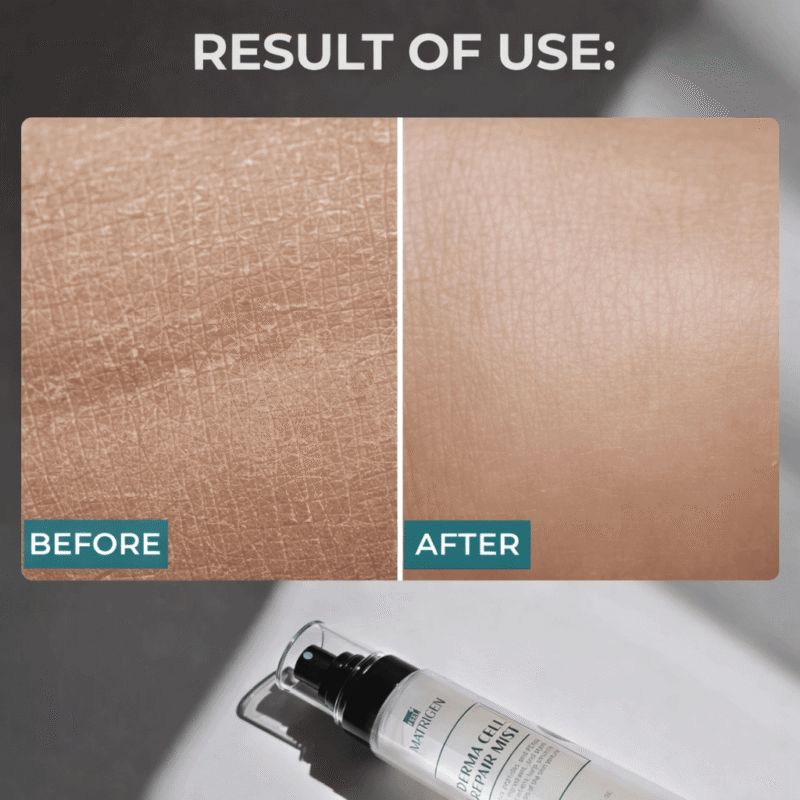 Matrigen Derma Cell Repair Mist