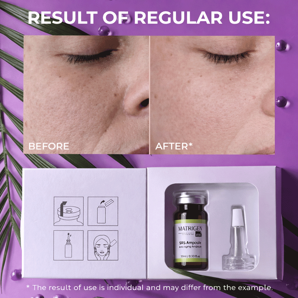 Matrigen SRS Anti-Aging Ampoules
